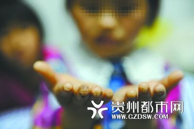 指尖被針扎得傷痕累累。