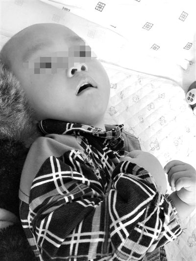 9月10日，陳揚(yáng)躺在醫(yī)院的病床上，他的眼睛仍然沒(méi)有聚焦感。新京報(bào)記者 朱柳笛 攝