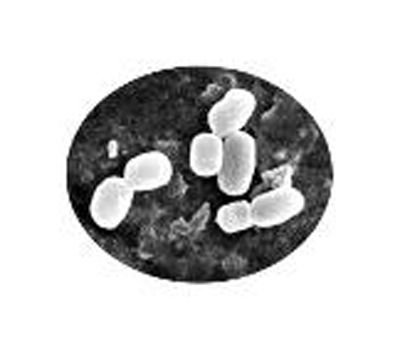 芽孢桿菌(資料照片) 芽孢桿菌(資料照片)