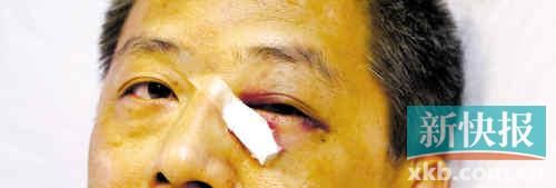 ■這起醫(yī)鬧事件，受傷的遠遠不只是熊旭明醫(yī)生的身體。