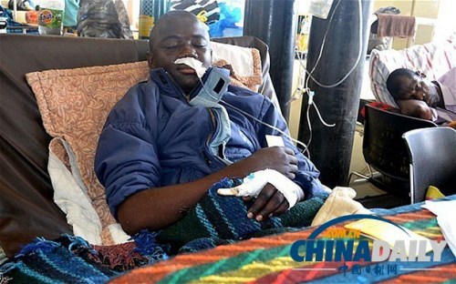 雖然已經(jīng)在醫(yī)院接受了近一個(gè)月的恢復(fù)治療，卡托卡的身體仍然非常虛弱。