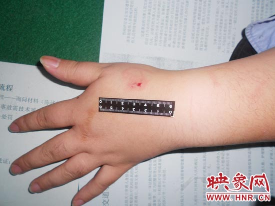 為幫助無(wú)證駕駛的朋友逃避處罰，新鄉(xiāng)的王某竟對(duì)執(zhí)勤民警大打出手，還將一名民警的手臂咬傷