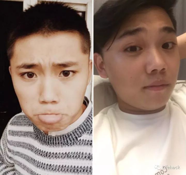 長胖20斤，臉型怎么變？這些例子看完扎心了！