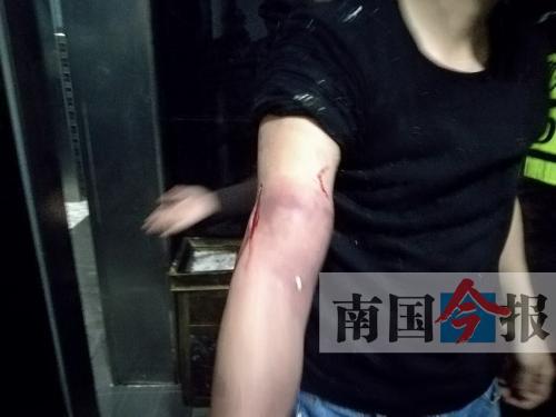 覃先生手臂被卡的部位受傷流血，所幸傷勢(shì)無大礙。 通訊員 王建民 攝