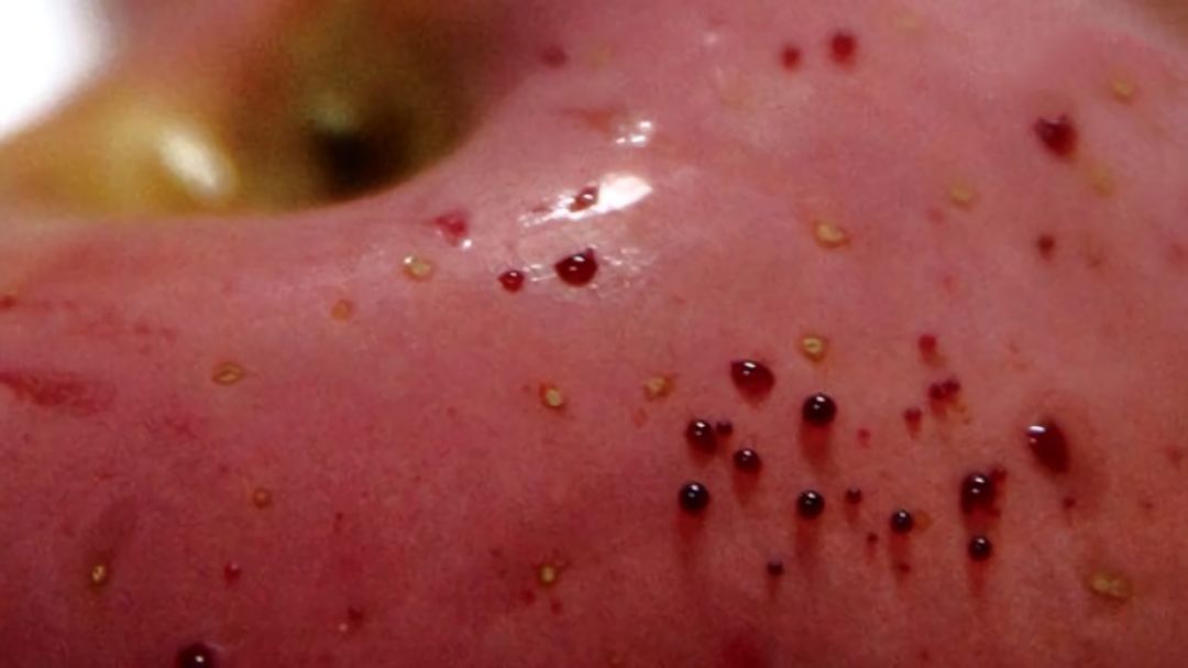 嚇懵！女子用熱水泡蘋(píng)果結(jié)果冒出血珠 咋回事？