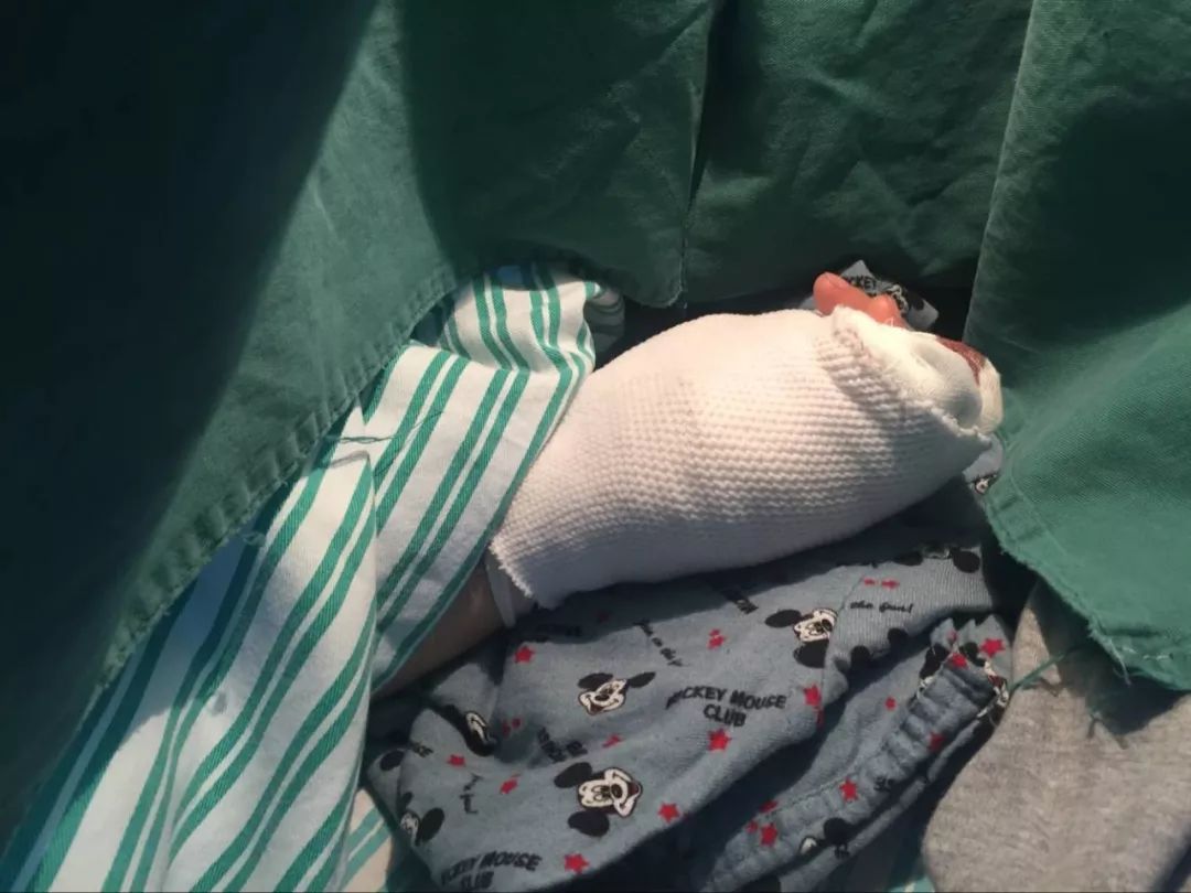 嚇哭！6歲男孩被夾斷手指 罪魁禍首竟是校服