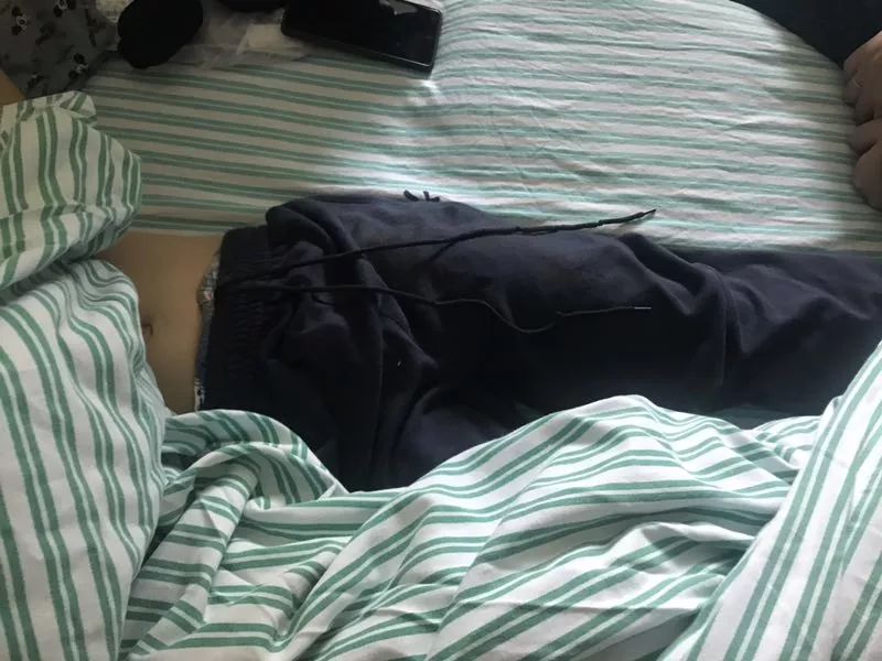 嚇哭！6歲男孩被夾斷手指 罪魁禍首竟是校服