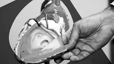 威廉斯領(lǐng)導(dǎo)的研究團(tuán)隊(duì)已經(jīng)利用人體脂肪干細(xì)胞，成功3D打印出心臟血管和心臟瓣膜，待一顆心臟的所有部件打