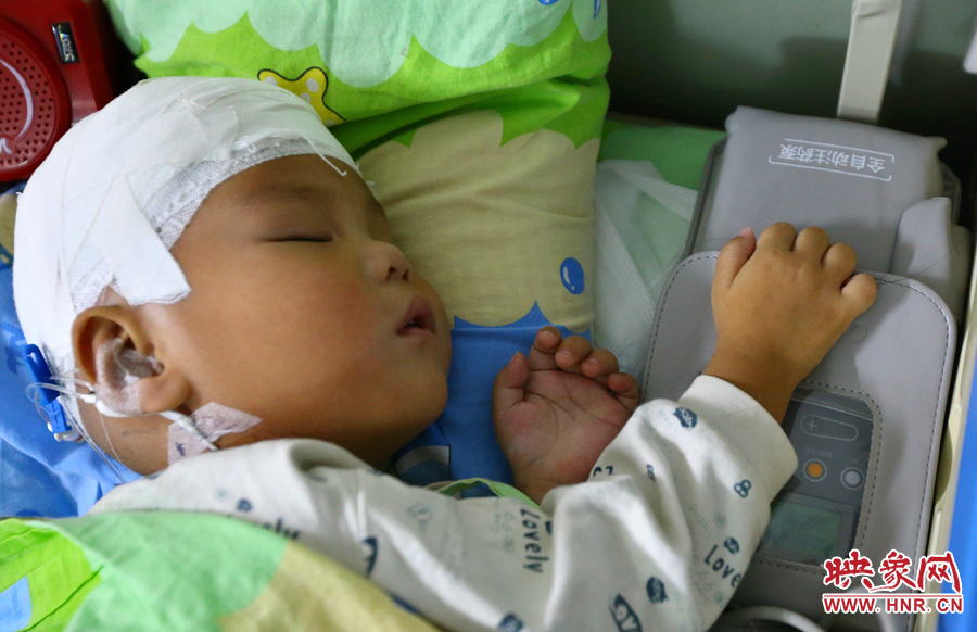 經(jīng)過(guò)手術(shù)，小龍病情已經(jīng)逐漸好轉(zhuǎn)，正在甜甜的熟睡