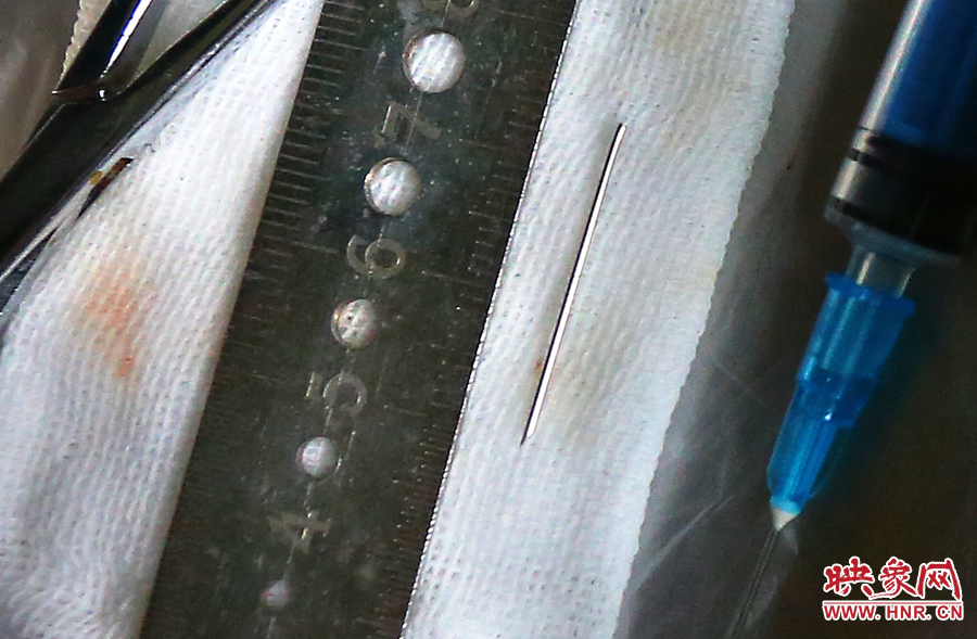 上午11點(diǎn)42分，大龍顱內(nèi)的鋼針被取出