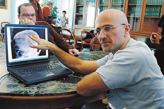 圖為卡納維洛醫(yī)生，不少人認(rèn)為他的想法非常瘋狂