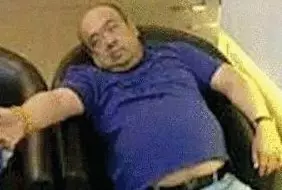 網(wǎng)傳金正男中毒后的照片。