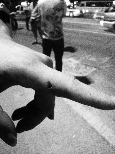 民警食指被咬傷。