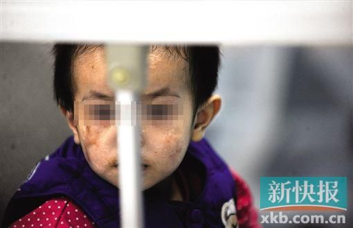 去年3月就能出院的小華(化名),目前還在廣州市婦兒醫(yī)療中心的PICU里住著。新快報(bào)記者 孫毅/攝