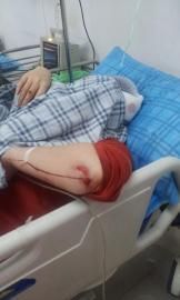 砸窗當(dāng)事人胡女士在醫(yī)院接受治療。