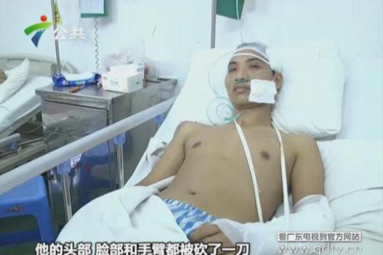 另一名傷者頭部、臉部和手臂都被砍了一刀。(視頻截圖)