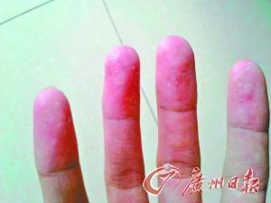 近百學(xué)生沒疊好被子遭體罰 校長(zhǎng):沒懲罰不叫教育