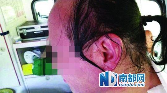 涉事教師遭熱水潑臉后的照片。