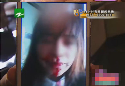 24歲女大學(xué)生被包養(yǎng) 意外懷孕遭對方帶人圍毆