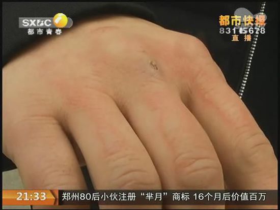 說(shuō)到這足療拔罐，估計(jì)大伙都不陌生，但是想起4號(hào)晚上的拔罐的經(jīng)歷，呂先生現(xiàn)在想起來(lái)，還心有余悸。