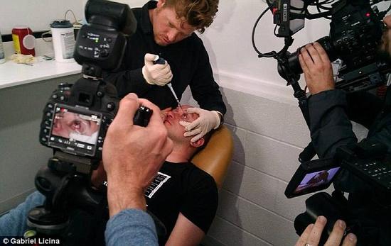 該實(shí)驗(yàn)是由加州一支名為“生物駭客”的實(shí)驗(yàn)團(tuán)隊(duì)開展的。他們使用了一種名為二氫卟吩e6（Ce6）的物質(zhì)的溶液。Ce6常見于深海魚體內(nèi)，有光敏特性，通常用于癌癥治療研究中。研究團(tuán)隊(duì)將Ce6與胰島素和鹽水混合起來，得到一種溶液，可以在低光照條件下提高人類的視力。