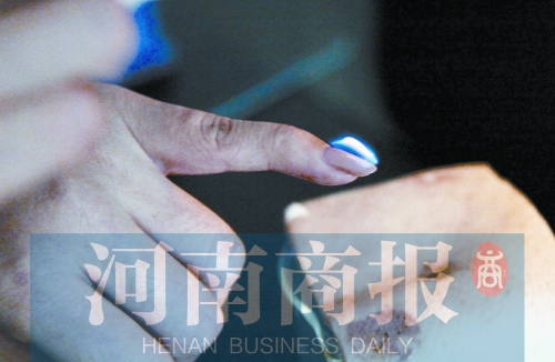 將指甲油涂在指甲上，靠近火焰時(shí)被引燃了