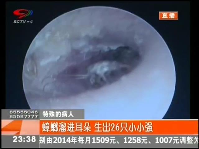 小強(qiáng)溜進(jìn)耳朵？生26只小小強(qiáng)