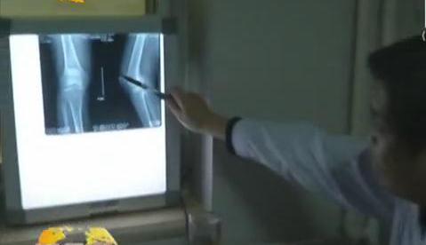 冷空氣來襲 如何預(yù)防老寒腿？