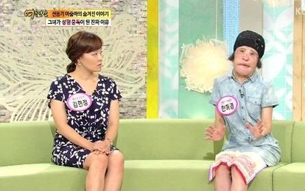 美女整容變“電風(fēng)扇大媽” 盤點(diǎn)整容失敗驚悚案例 美女整容變“電風(fēng)扇大媽” 盤點(diǎn)整容失敗驚悚案例